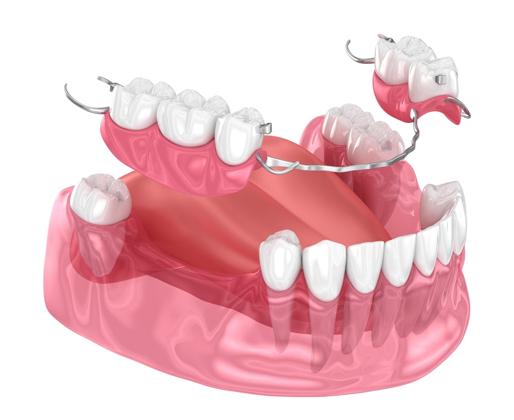 Dentures and Partials