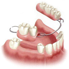 Dentures and Partials